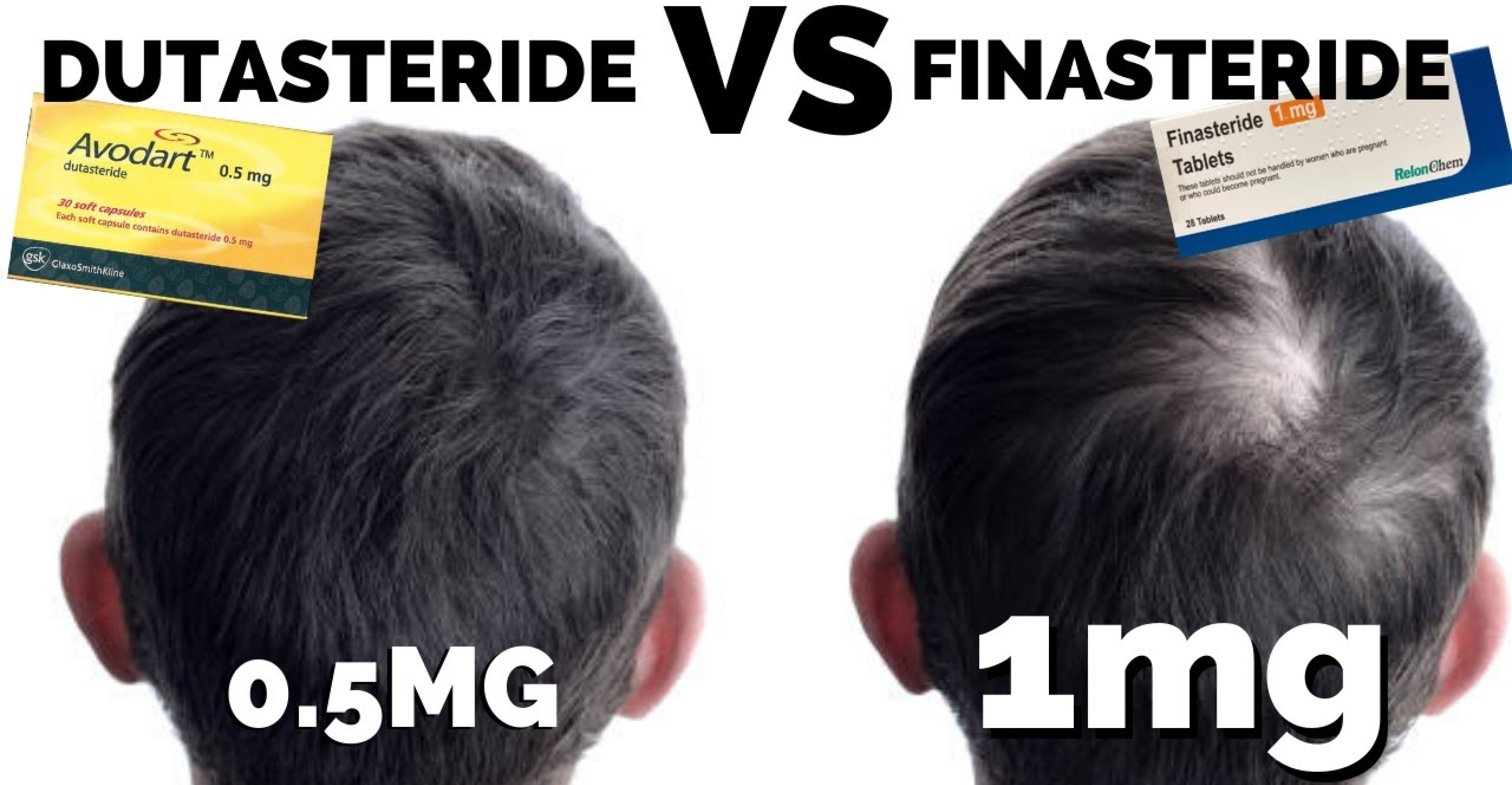 dutasteride vs finasteride